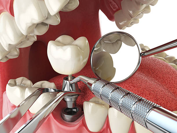 Best Emergency Dentist for Knocked-Out Tooth in Moreland Hills, OH